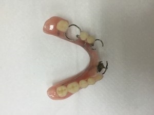 全部床義歯と部分床義歯について | 習志野市の歯科スマイル