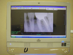 デジタル・レントゲンについて - 医療法人社団ほほえみ会スマイル
